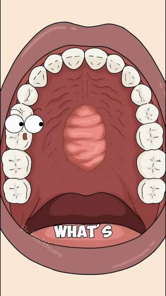 What Is The Lump In The Roof Of My Mouth?